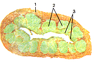 Лимфоидные узелки в стенке аппендикса