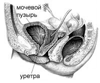 СТРЕССОВОЕ НЕДЕРЖАНИЕ МОЧИ