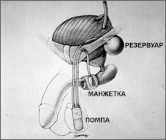 сфинктер